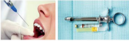 胰島素，牙科麻醉6.png